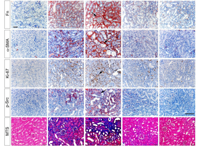 南方医科大学研究者们揭示了巨噬细胞促进肾脏纤维化的新机制