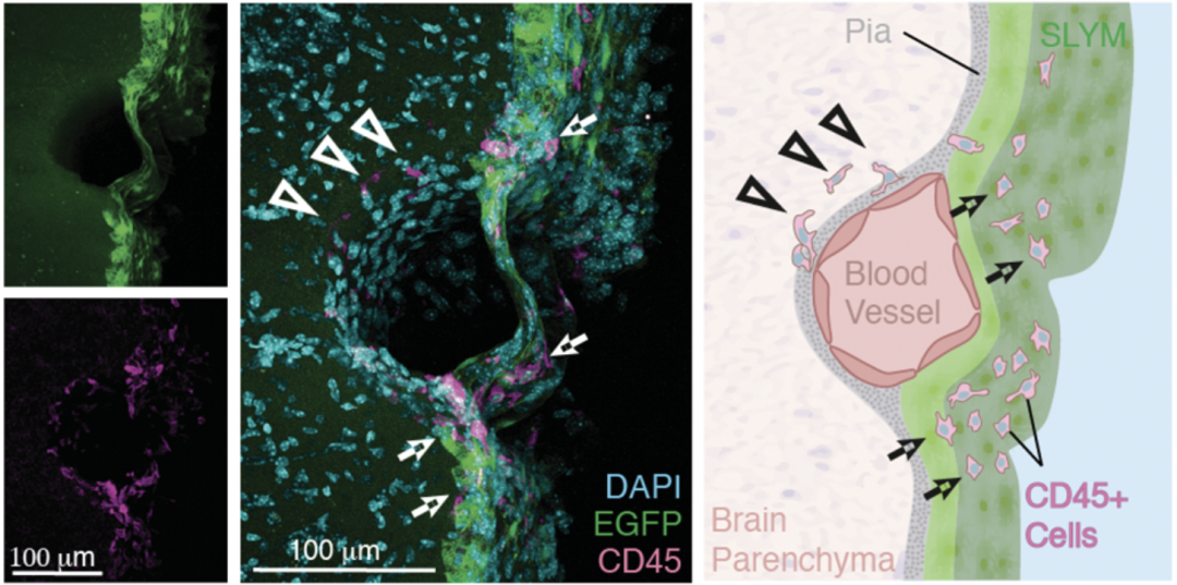 《科学》：改写教科书！科学家首次发现，人类大脑或存在第四层脑膜！