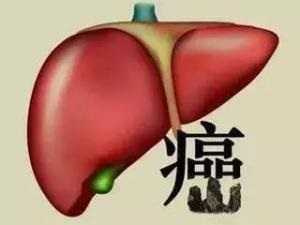 肝癌(HCC)“免疫+靶向”治疗！信达生物/礼来达伯舒®+达攸同®方案疗效显著：总缓解率34%，疾病控制率78%!