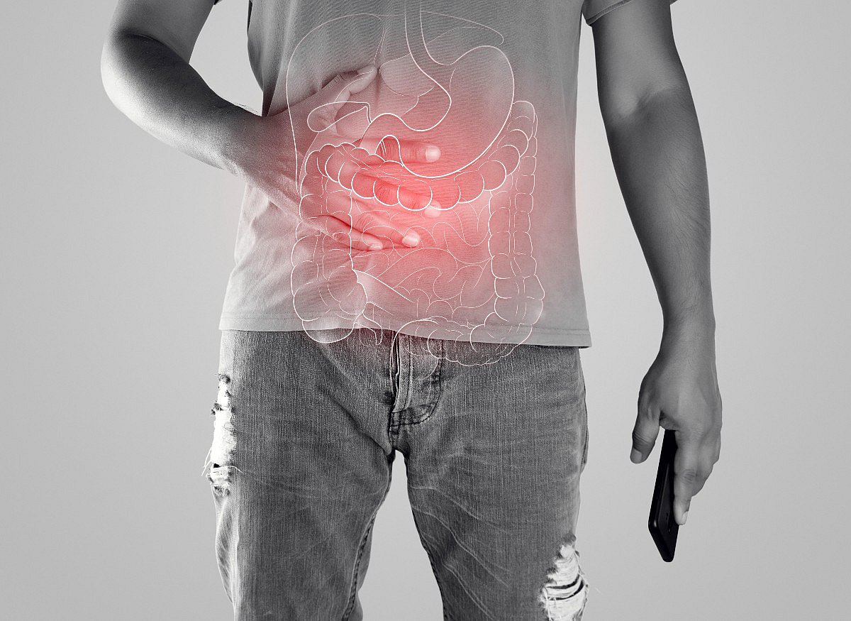 Colorectal Cancer Rates Shifting to Younger Groups as Rectal Cancer Rates Spike