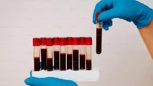 Expression Therapeutics Receives FDA Fast Track and Rare Pediatric Disease Designations for Investigational Stem Cell Therapy for Hemophilia A