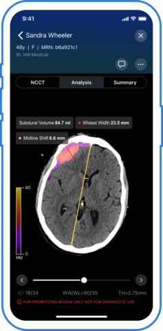 Viz.ai Receives First and Only FDA 510(k) Clearance for Subdural Measurements