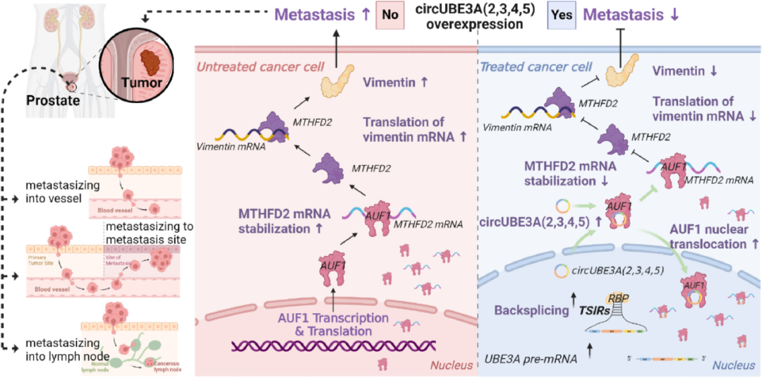 环状RNA新发现！复旦大学发文揭示癌症转移最新分子机制和预防靶点