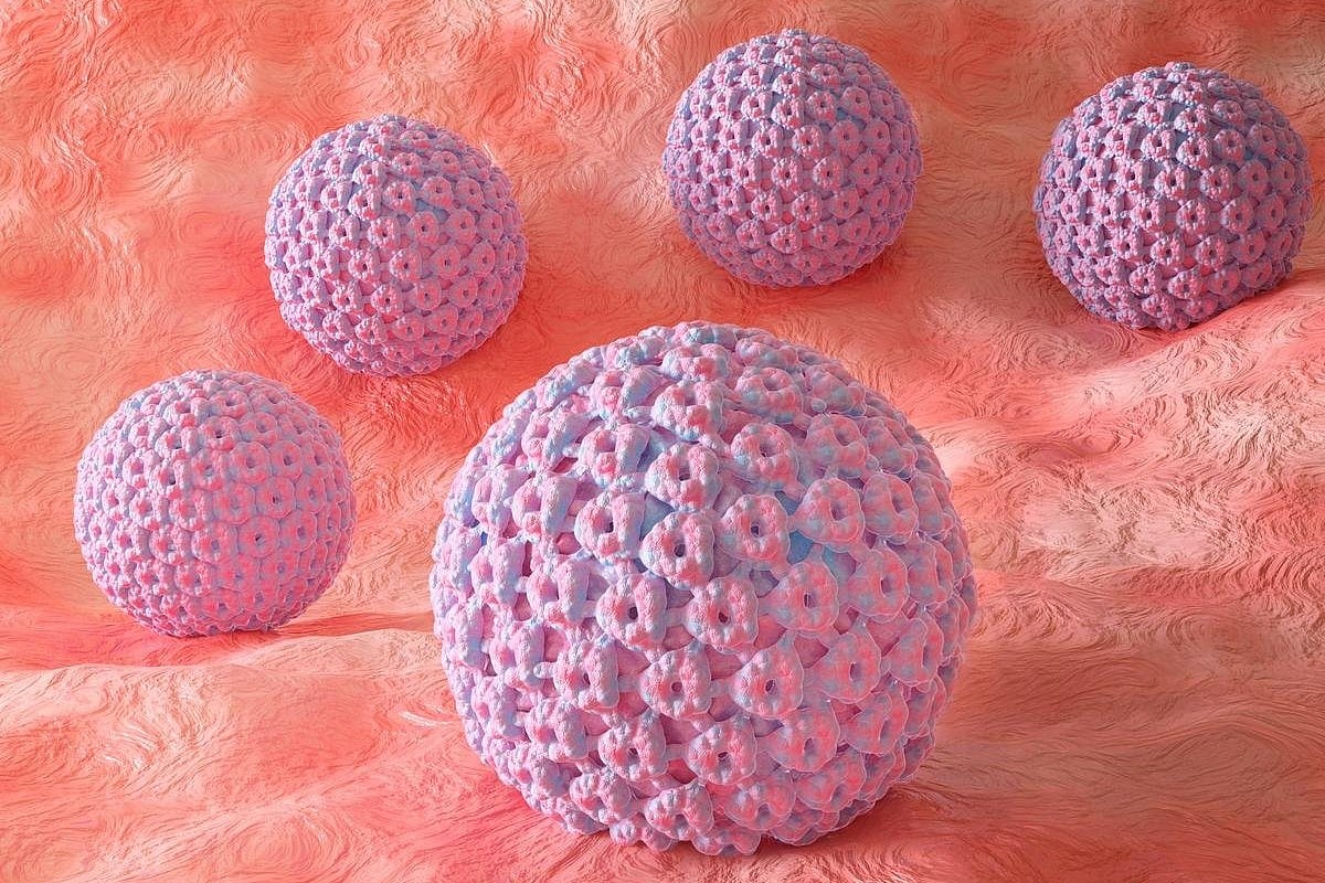 Thyroid Eye Disease Tied to Higher Prevalence of Human Papillomavirus