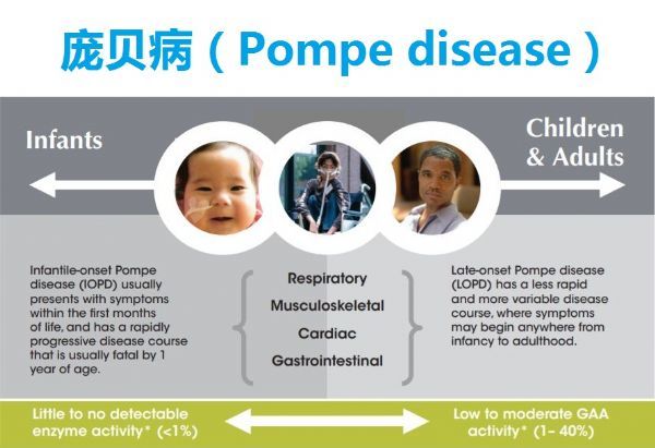 庞贝病第二代酶替代疗法（ERT）！欧盟批准赛诺菲Nexviadyme(avalglucosidase alfa)!