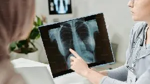 Immutep to Present Pivotal TACTI-004 Trial in Progress Poster at the 2025 World Conference on Lung Cancer