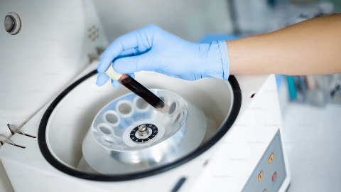 Chemomab Reports Positive Results in Nebokitug Phase 2 PSC Open Label Extension Trial Showing Continued Broad and Substantial Improvements in Key Liver Biomarkers