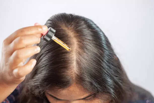Hair-loss drug under lens over threat to infants, eye disorders