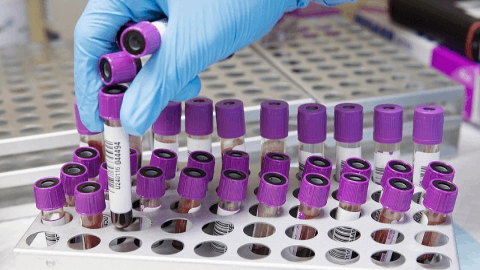 EXACT Therapeutics announces positive final results in Phase 1 ACTIVATE trial in liver metastases from colorectal cancer