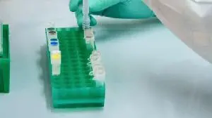 Samsung Bioepis Highlights Consistent Efficacy of SB16 (OBODENCE®; Denosumab) Across Osteoporosis Patient Subgroups at WCO-IOF-ESCEO 2026