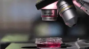 Galimedix Therapeutics completes single ascending dose part of Phase 1 study with oral small molecule, GAL-101, an amyloid beta aggregation modulator
