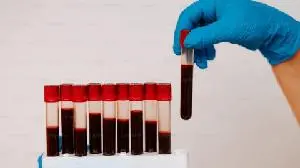 Artios Reports Randomized Phase 2a Study of Low Dose Alnodesertib  Plus Gemcitabine Achieves Primary Endpoint  in Platinum-Resistant Ovarian Cancer