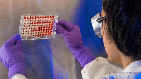 Vera’s newly approved IgA nephropathy drug supports kidney function, like Otsuka’s Voyxact