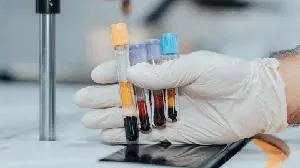 Sanofi and Regeneron’s Dupixent approved in the EU as the first targeted medicine to treat young children with chronic spontaneous urticaria