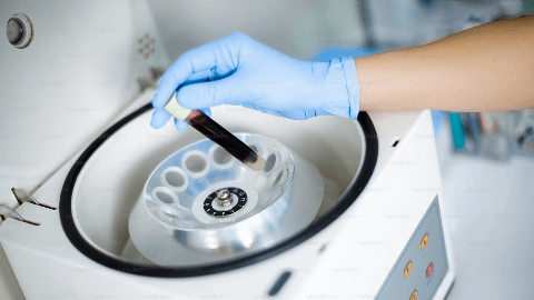 BioCardia Announces First Patient in Phase 3 Randomized Controlled Double-Blind CardiAMP HF II Clinical Trial of the Company’s Lead Cell Therapy for Treatment of Heart Failure