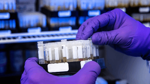 Lexeo Therapeutics Announces FDA Breakthrough Therapy Designation for LX2006 in Friedreich Ataxia