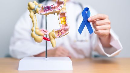 MHRA approves Takeda’s fruquintinib for metastatic colorectal cancer