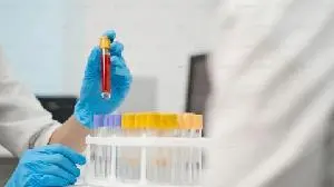 OSE Immunotherapeutics Welcomes FDA Orphan Drug Designation Granted to Pegrizeprument (VEL-101)