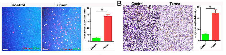 南方医科大学研究者们揭示了circRNA_0013936有望成为膀胱癌的有效治疗靶点