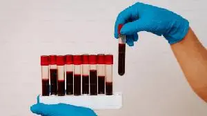 Tessera says infusion edits 85% of blood cells, pointing to off-the-shelf sickle cell fix