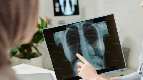 Avalyn Completes Oversubscribed $100 Million Series D Financing to Further Advance Clinical Development of Novel Inhaled Therapies for Pulmonary Fibrosis