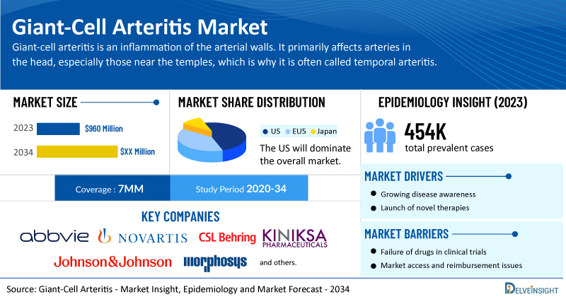 Giant-Cell Arteritis Market Heats up with AbbVie’s RINVOQ Approval | DelveInsight