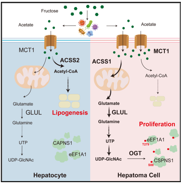 重庆医科大学的研究者们揭示了一种很有前途的肝细胞癌治疗方法