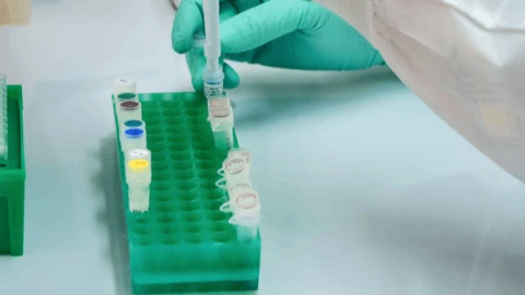 Mirum Pharmaceuticals and Incyte Announce U.S. FDA Approval of Atebrioz™ (zilurgisertib) for Adult and Pediatric Patients with Fibrodysplasia Ossificans Progressiva