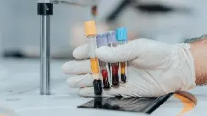 AbelZeta Receives FDA Clearance of Registrational Phase II Trial for C-CAR168 in Refractory Lupus Nephritis