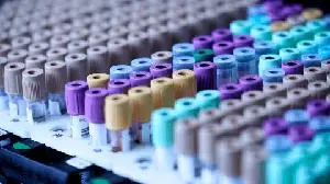 Antengene Receives IND Approval for ATG-201 (CD19 × CD3 TCE) in Autoimmune Disease in China