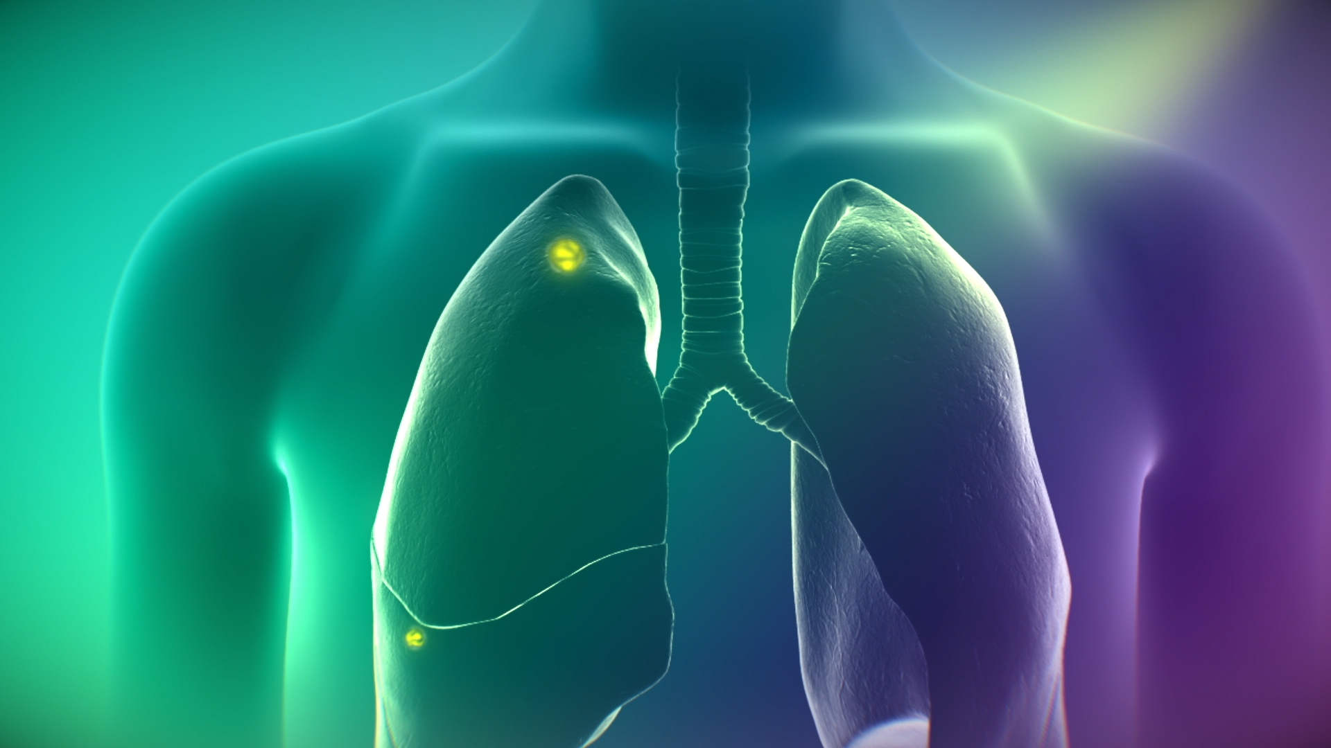 On Target Laboratories Announces Expanded Indication of CYTALUX® (pafolacianine) injection for Detection of Lung Cancer During Surgery