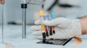 BridgeBio to Present Phase 2 Proof-of-Concept Data for Encaleret in Post-Surgical Hypoparathyroidism