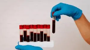 Genprex Collaborators Present Positive Preclinical Data on Diabetes Gene Therapy for Type 2 Diabetes at the 2026 American Society of Gene and Cell Therapy Annual Meeting