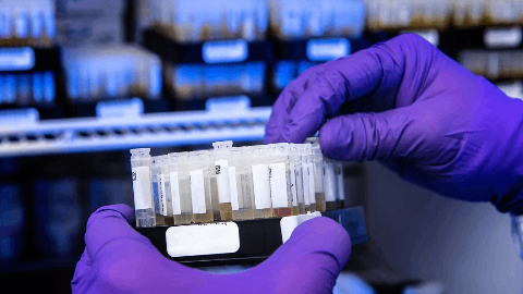 Monopar Presents ALXN1840 Late-Breaker Data at EASL 2025