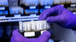 Monopar Presents ALXN1840 Late-Breaker Data at EASL 2025
