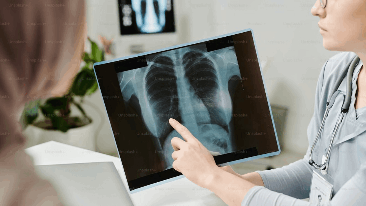 Boehringer’s new zongertinib data demonstrate durable and clinically meaningful results in patients with HER2 (ERBB2)-mutant advanced NSCLC