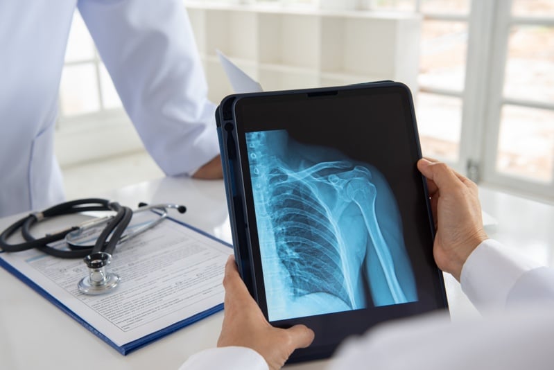 Orthopedic implant maker Shoulder Innovations sets terms for $100M+ IPO