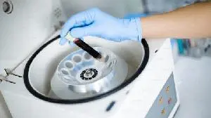 iSTAR Medical’s MINIject® demonstrates significant sustained 5-year efficacy in treating glaucoma in STAR-GLOBAL trial