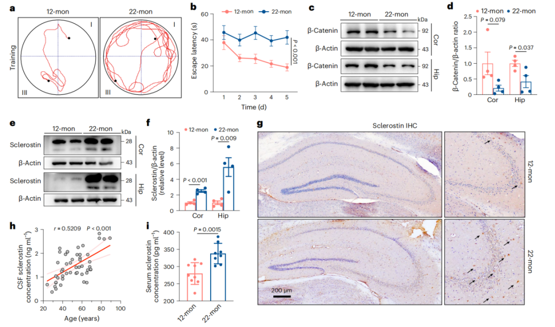 《自然·代谢》：南京鼓楼医院团队发现，硬骨蛋白异常升高会加速阿尔茨海默病发展！