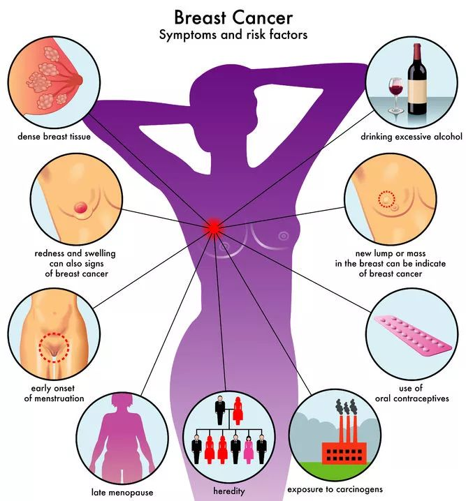 前沿 |《科学》子刊：三阴性乳腺癌治疗新策略——靶向这种免疫细胞