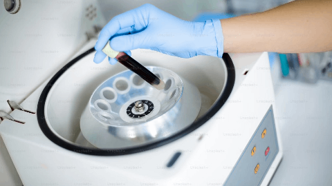 Vera Therapeutics Announces Atacicept Achieved 46% Proteinuria Reduction in ORIGIN Phase 3 Trial in Adults with IgA Nephropathy