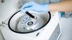 Vera Therapeutics Announces Atacicept Achieved 46% Proteinuria Reduction in ORIGIN Phase 3 Trial in Adults with IgA Nephropathy
