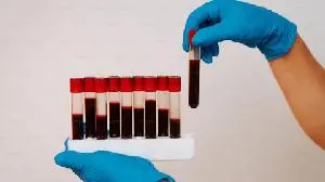 CHARM Therapeutics advances CHM-029, a next-generation menin inhibitor designed to overcome resistance mutations, as its first clinical candidate for acute myeloid leukaemia (AML)