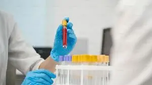 Myqorzo and Redemplo approved in China