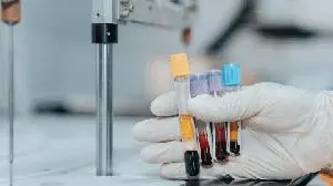 Jazz to withdraw Zepzelca with FDA in second-line small cell lung cancer