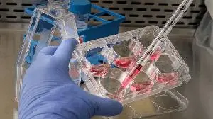 Aptevo Strengthens Solid Tumor Strategy with Patent Filing for Nectin-4 x PD-L1 Dual Targeting Backbone