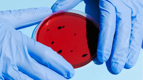 Lipella Pharmaceuticals Completes Enrollment in Phase 2a Trial of LP-310 for Oral Lichen Planus
