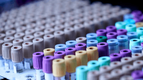 Purespring announces publication of notable study highlighting an under recognised genetic driver of adult-onset FSGS, in particular in US and UK populations