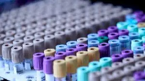 Purespring announces publication of notable study highlighting an under recognised genetic driver of adult-onset FSGS, in particular in US and UK populations