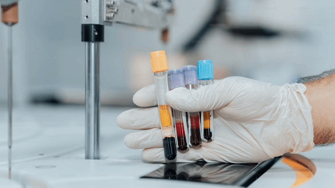 Kyverna Therapeutics Highlights Potential of KYV-101 in Multiple Sclerosis with Data from Phase 1 Investigator-Initiated Trials to be Presented at ECTRIMS